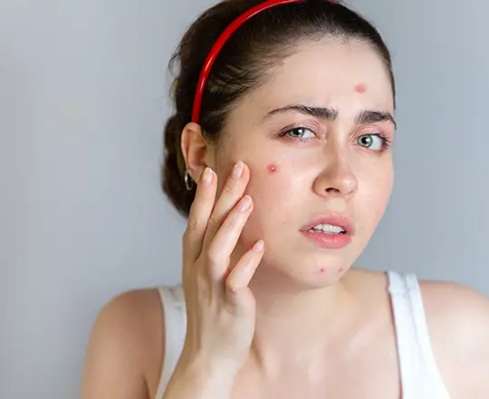 Facial Treatment