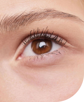 Eye care