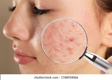 Facial Treatment